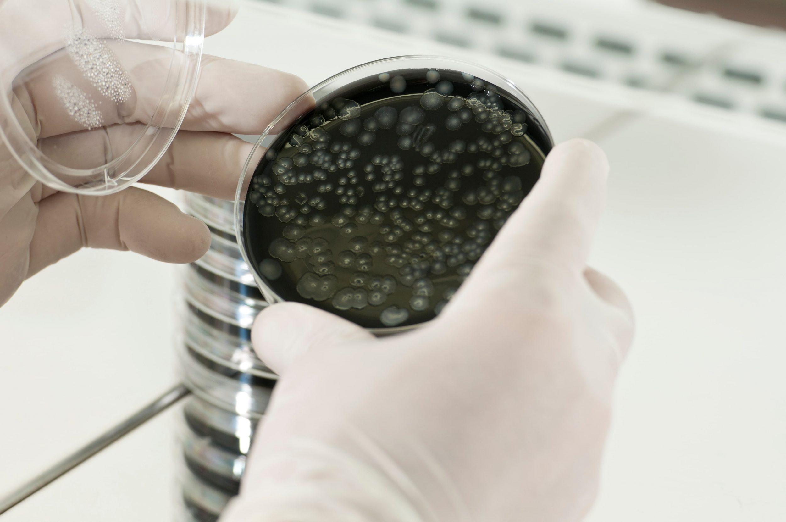 Legionella Water Testing And Control Total Water Solutions