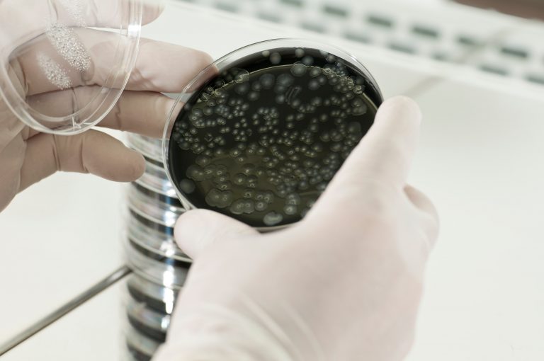 Legionella Water Testing & Control - Total Water Solutions